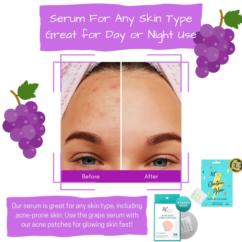 Hyaluronic Acid Vitamin C